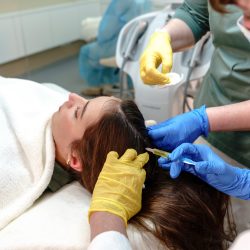 Close-up of two professionals administering a mesotherapy injection for hair growth on a young woman scalp, ensuring precision and care in a clinical setting